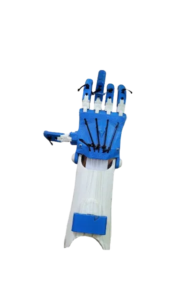 The 3D-printed robotic hand: blue fingers with tendon cords on a white forearm